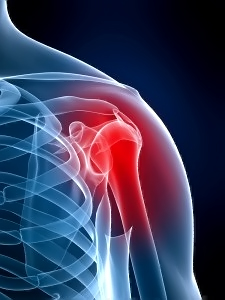 Boot-Camp-Exercise-Injury-Prevention
